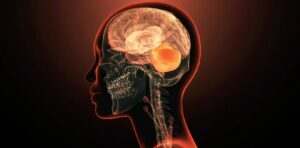 Illustration of a human profile with an overlay of the brain, highlighting anatomical structures. The skull and spine are visible, with a glowing effect emphasizing the brain's location.