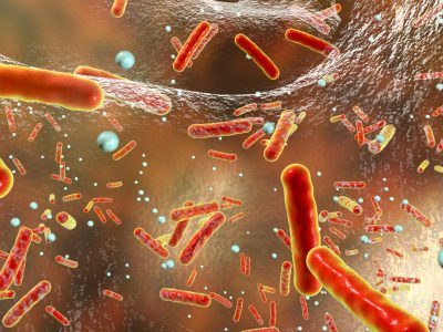 Superbugs