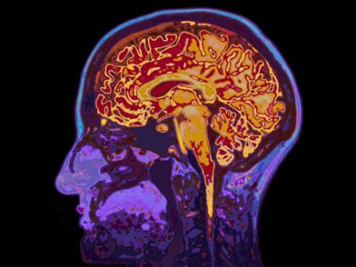 Image of a brain scan